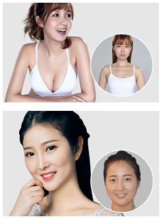 南京艺星医疗美容手术案例前后对比图