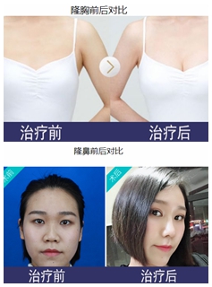 株洲爱思特医疗美容门诊部案例